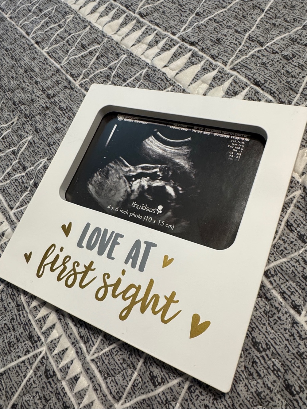 Ultrasound photo frame